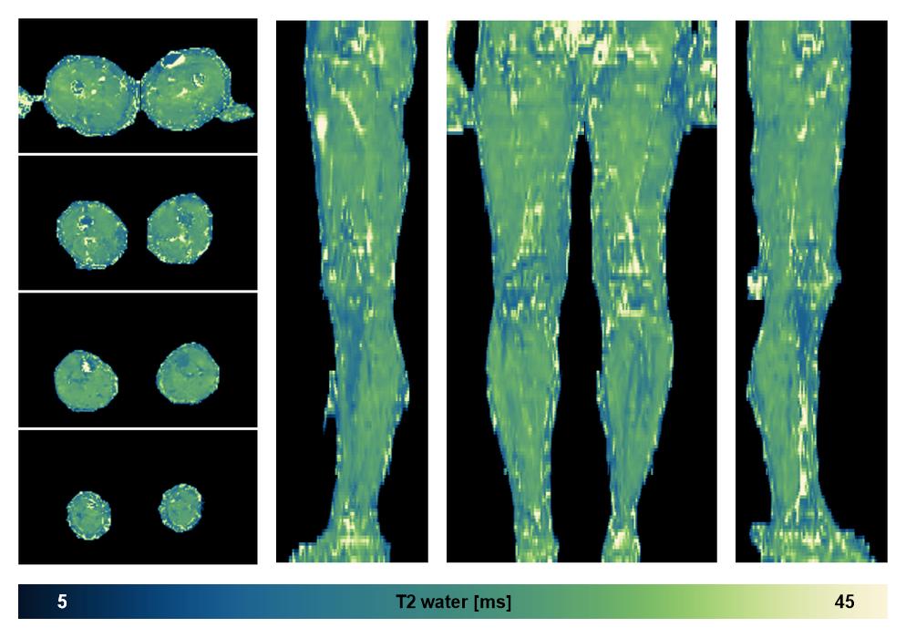 The water only T2 relaxation time of the lower extremity obtained from multi echo spin echo t2 mapping with EPG based reconstruction.